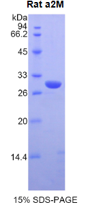 Alpha-2-Macroglobulin (a2M)