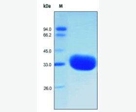 Recombinant Human Phosphoserine Phosphatase/PSP