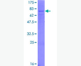 Recombinant Human C-C Motif Chemokine 27/CCL27
