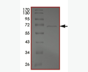 Recombinant Human Parathyroid Hormone/Parathormone/PTH