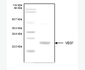 Recombinant Human Interleukin-37/IL-37
