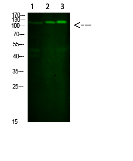 SREBP-1 Polyclonal Antibody