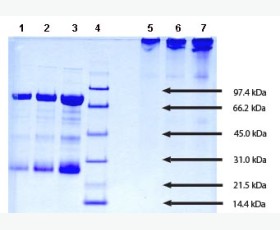 Recombinant Human Esterase D