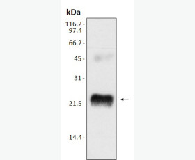 Recombinant Mouse Interleukin-13/IL-13