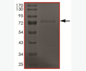 Recombinant Human Interleukin-36α/IL-36α
