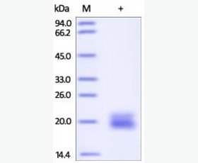 Recombinant Human Interleukin-2/IL-2