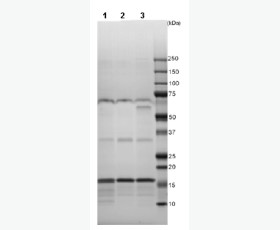 Recombinant Human Uroporphyrinogen Decarboxylase/UROD