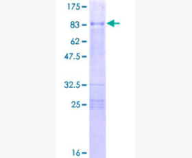 Recombinant Human β-Defensin 4/DEFB4