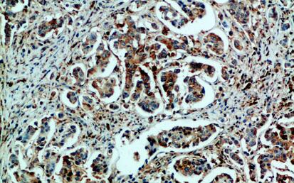 GRP78 BiP Polyclonal Antibody