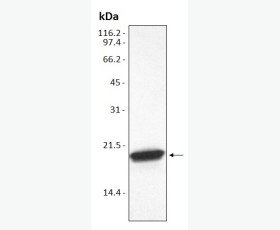 Recombinant Mouse Interleukin-1β/IL-1β