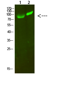 GCK/GLK Polyclonal Antibody