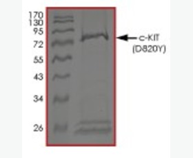 Recombinant Human Interleukin-6/IL-6