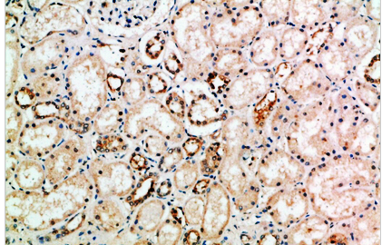 NT-3 Polyclonal Antibody