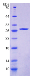 Recombinant Collagen Type IV Alpha 4 (COL4a4)