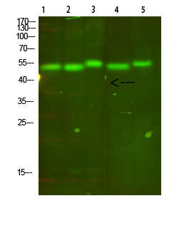 Cytochrome b Polyclonal Antibody