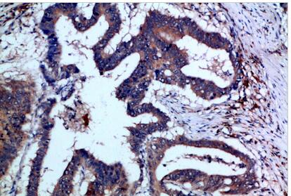 IL-17F Polyclonal Antibody