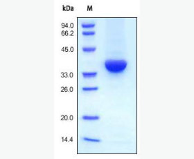 Recombinant Human Annexin A7/ANXA7