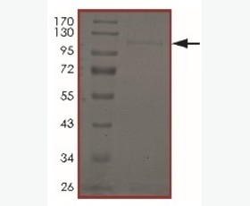 Recombinant Mouse Fibroblast Growth Factor 1/FGF-1/FGFa
