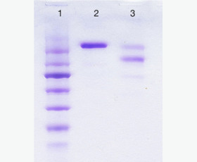 Recombinant Human Protein Kinase C Type ε/PKC ε/PKCE