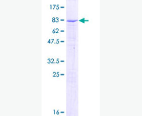 Recombinant Human β-Arrestin 1/ARRB1