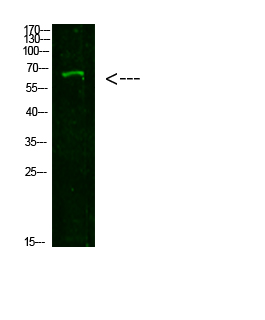 NUT Polyclonal Antibody