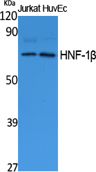 HNF-1β Polyclonal Antibody