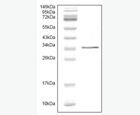 Recombinant Human Fatty Acid-Binding Protein 4/FABP4/A-FABP/aP2
