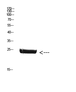 CSH1 Polyclonal Antibody