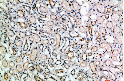 TGFβ3 Polyclonal Antibody