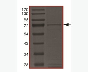 Recombinant Human IL-36 Receptor Antagonist Protein/IL-36RN/IL-1F5