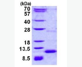 Recombinant Human Fatty Acid-Binding Protein 3/FABP3/H-FABP