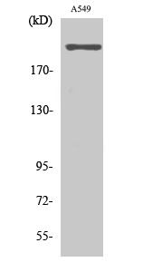 T-type Ca++ CP α1H Polyclonal Antibody