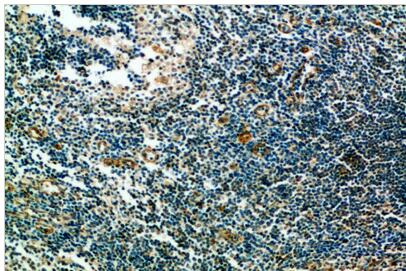 ST6GAL1 Polyclonal Antibody