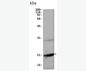 Recombinant Human Bone Morphogenetic Protein 2/BMP-2