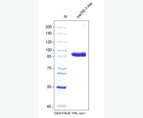 Recombinant Human TNF-Like 1/TL1A/TNFSF15