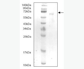 Recombinant Human C-C Motif Chemokine 1/CCL1