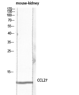 CTACK Polyclonal Antibody