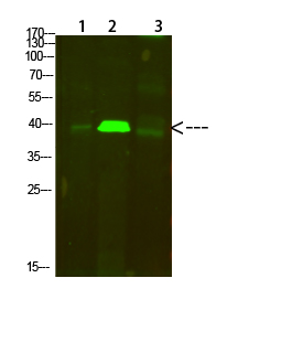 Tropomyosin α Polyclonal Antibody