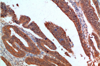 PDGF-C Polyclonal Antibody