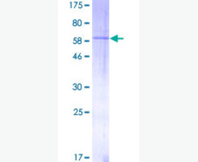 Recombinant Human Fibroblast Growth Factor 23/FGF-23