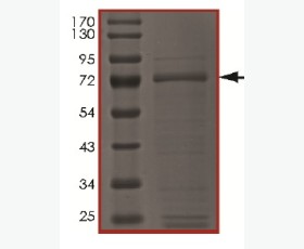 Recombinant Human Sonic Hedgehog/SHH C24II