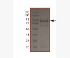 Recombinant Human Glutamine Synthetase/GLUL
