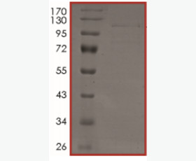 Recombinant Human Karyopherin Subunit α-2 /KPNA2/IPOA1