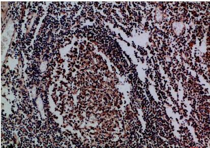 IL-17D Polyclonal Antibody