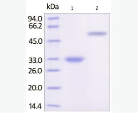 Recombinant Human Interleukin-38/IL-38/IL-1F10