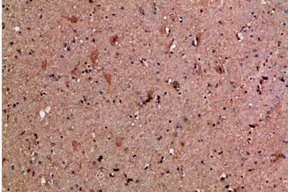 NNT-1 Polyclonal Antibody