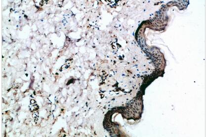 Frizzled-4 Polyclonal Antibody