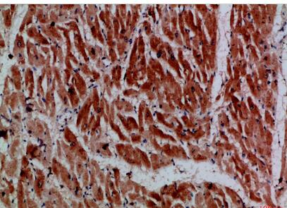 MYH6/MYH7 Polyclonal Antibody