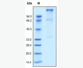 Recombinant Human Ubiquitin-Conjugating Enzyme E2 A/UBE2A