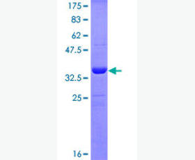Recombinant Human Bcl-2-Llike Protein 2/BCL2L2